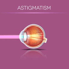 Astigmatism